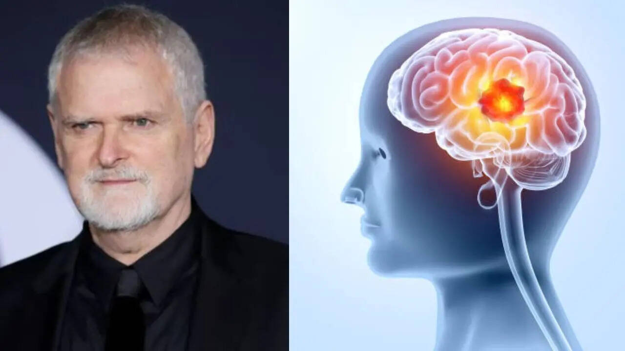 50 Shades Director James Foley Dies of Brain Cancer, Know the Early Symptoms 50 Shades Director James Foley Dies of Brain Cancer, Know the Early Symptoms